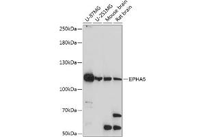 Western blot analysis of extracts of various cell lines, using EPH antibody (ABIN7266971) at 1:1000 dilution. (EPH Receptor A5 anticorps  (AA 1-130))