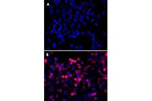 Immunofluorescence staining of HEK293 cells.