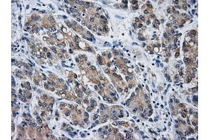 Immunohistochemistry (IHC) image for anti-Aldo-Keto Reductase Family 1, Member A1 (Aldehyde Reductase) (AKR1A1) antibody (ABIN1496541) (AKR1A1 anticorps)