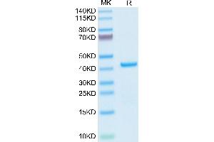 Aminoacyl tRNA Synthetase Complex-Interacting Multifunctional Protein 1 (AIMP1) (AA 2-312) protein (His tag)