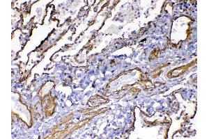 IHC analysis of VEGF Receptor 3 using anti-VEGF Receptor 3 antibody .