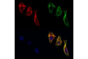 ABIN7093805 and ABIN7097848 staining Hela cells by IF/ICC.