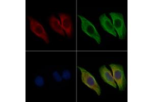ABIN6265399 and ABIN6267024 staining Hela cells by IF/ICC. (SDC4 anticorps  (C-Term))