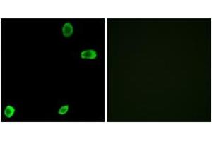 Immunofluorescence analysis of A549 cells, using TAS2R39 Antibody. (TAS2R39 anticorps  (AA 218-267))
