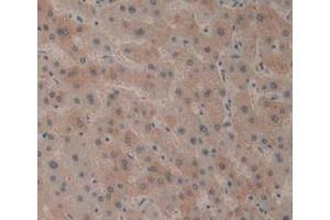 Detection of CD161 in Human Liver Tissue using Polyclonal Antibody to Cluster Of Differentiation 161 (CD161)