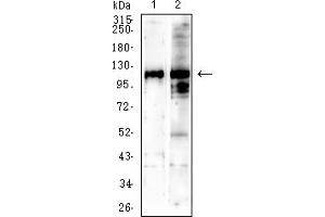 Western blot analysis using SALL4 mouse mAb against NIH/3T3 (1) C2C12 (2) cell lysate. (SALL4 anticorps  (AA 96-359))