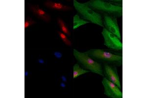 ABIN6260755 and ABIN6278972 staining  cells by IF/ICC. (CENPH anticorps  (N-Term))
