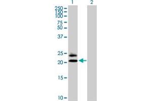 Western Blot analysis of MS4A5 expression in transfected 293T cell line by MS4A5 MaxPab polyclonal antibody. (MS4A5 anticorps  (AA 1-200))