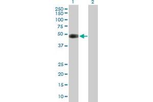 Western Blot analysis of CDK5R2 expression in transfected 293T cell line by CDK5R2 MaxPab polyclonal antibody.