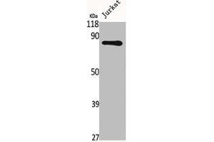 Western Blot analysis of Jurkat cells using Fyb Polyclonal Antibody (FYB1 anticorps  (C-Term))