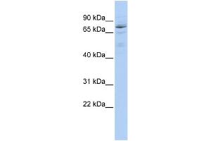 WB Suggested Anti-HIC1 Antibody Titration:  0. (HIC1 anticorps  (Middle Region))