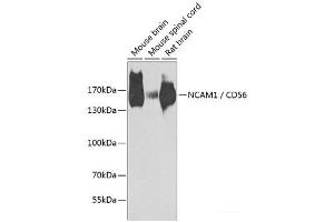 Western blot analysis of extracts of various cell lines using NCAM1 / CD56 Polyclonal Antibody at dilution of 1:1000. (CD56 anticorps)
