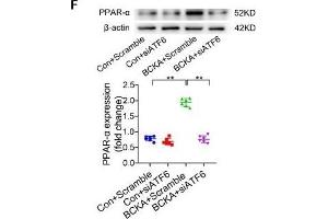 BCAA increase PPAR-α expression in a GCN2/ATF6 pathway-dependent manner. (beta Actin anticorps)