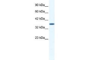 WB Suggested Anti-ANXA3 Antibody Titration:  1. (Annexin A3 anticorps  (C-Term))