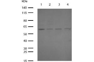 All lanes : YES1 Rabbit mAb at 1/1k dilution Lane 1 : 3T3 whole cell lysates Lane 2 : PC12 whole cell lysates Lane 3 : C2C12 whole cell lysates Lane 4 : C6 whole cell lysates Lysates/proteins at 20 μg per lane.