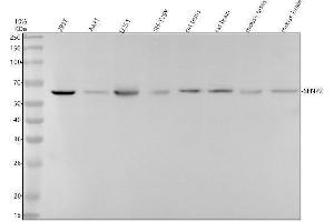 Western blot analysis of SENP2 using anti-SENP2 antibody (ABIN7606266).