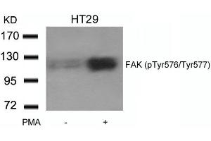Western blot analysis of extracts from HT29 cells untreated or treated with PMA using FAK(phospho-Tyr576/Tyr577) Antibody. (FAK anticorps  (pTyr576, pTyr577))
