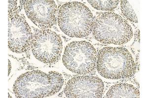 MKK3/MKK6 Mouse Monoclonal Antibody at 1/100 staining rat testis tissue by IHC-P. (MAP2K3 anticorps)