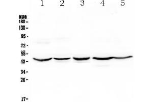 Western blot analysis of HMBS using anti-HMBS antibody . (HMBS anticorps  (AA 6-361))