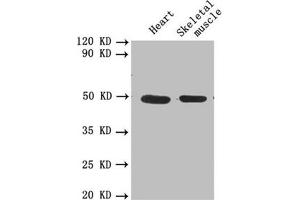 Western blot All lanes: PLAU antibody at 1. (PLAU anticorps  (AA 21-173))