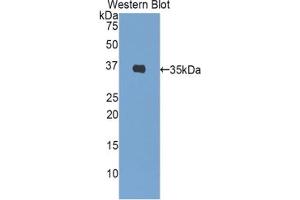 Western blot analysis of the recombinant protein. (Insulin anticorps  (AA 88-108))