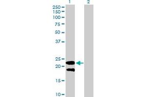 Western Blot analysis of LY6G5B expression in transfected 293T cell line by LY6G5B MaxPab polyclonal antibody. (LY6G5B anticorps  (AA 1-201))