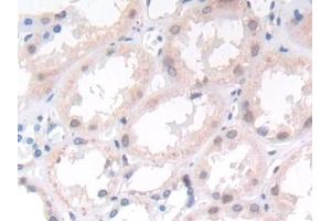 Detection of ST14 in Human Kidney Tissue using Monoclonal Antibody to Suppression Of Tumorigenicity 14 (ST14)