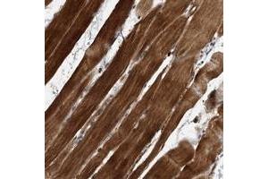 Immunohistochemical staining of human skeletal muscle with SOBP polyclonal antibody  shows strong cytoplasmic positivity in myocytes at 1:200-1:500 dilution. (SOBP anticorps)