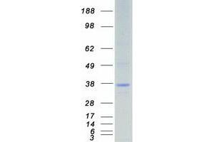 serine/threonine Kinase 16 (STK16) (Transcript Variant 1) protein (Myc-DYKDDDDK Tag)