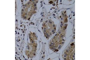 Immunohistochemistry of paraffin-embedded human stomach using TNFRSF6B antibody (ABIN5970241) at dilution of 1/200 (40x lens). (TNFRSF6B anticorps)