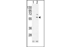 Western blot analysis of RPS6KL1 (arrow) using RPS6KL1 Antibody . (RPS6KL1 anticorps)