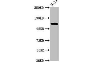 Western Blot Positive WB detected in: Hela whole cell lysate All lanes:NAT10 antibody at 7 μg/mL Secondary Goat polyclonal to rabbit IgG at 1/50000 dilution Predicted band size: 116, 108 kDa Observed band size: 116 kDa (NAT1 anticorps  (AA 909-1025))