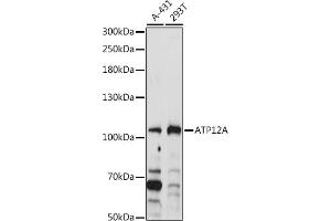 Western blot analysis of extracts of various cell lines, using A antibody (ABIN7265768) at 1:1000 dilution. (ATP12A anticorps  (AA 890-980))