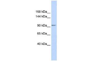 KCTD19 antibody used at 1 ug/ml to detect target protein. (KCTD19 anticorps  (N-Term))