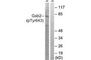 Western blot analysis of extracts from Jurkat cells treated with IFN 2500U/ML 30', using Gab2 (Phospho-Tyr643) Antibody. (GAB2 anticorps  (pTyr643))
