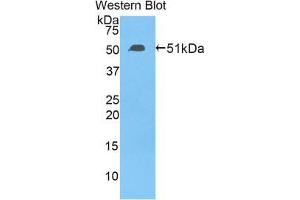Western blot analysis of the recombinant protein. (TFAM anticorps  (AA 43-244))