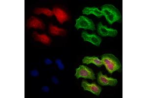 ABIN6265289 and ABIN6273076 staining Hela cells by IF/ICC. (SRP68 anticorps  (C-Term))
