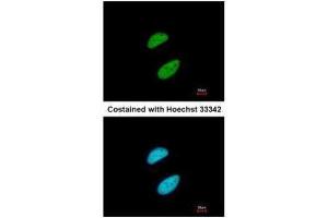ICC/IF Image Immunofluorescence analysis of paraformaldehyde-fixed HeLa, using KAP1, antibody at 1:200 dilution. (KAP1 anticorps  (N-Term))