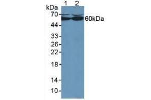 Western blot analysis of (1) Human HepG2 Cells and (2) Human HeLa cells. (Catalase anticorps  (AA 80-239))
