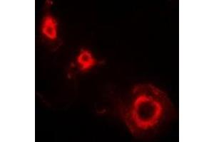Immunofluorescent analysis of Ferritin L staining in HepG2 cells. (Ferritin L anticorps)