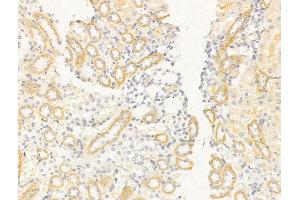 ABIN6261605 and ABIN6268755 at 1/100 staining Rat kidney tissue by IHC-P. (EpCAM anticorps  (Internal Region))