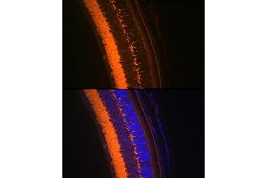 Immunofluorescence analysis of mouse eye using V Rabbit mAb (ABIN7271313) at dilution of 1:100 (40x lens).