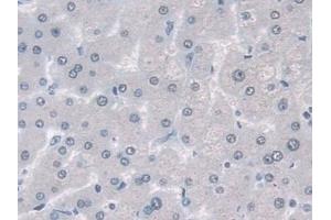 Detection of Ub in Human Liver Tissue using Polyclonal Antibody to Ubiquitin (Ub)