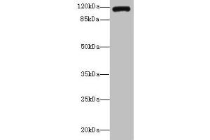 Western blot All lanes: INVS antibody IgG at 14 μg/mL + K562 whole cell lysate Secondary Goat polyclonal to rabbit IgG at 1/10000 dilution Predicted band size: 118, 100, 11 kDa Observed band size: 118 kDa (Inversin anticorps  (AA 1-101))