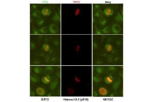 ICC/IF analysis of HeLa cells, fixed fixed by anhydrous methanol at -20oC, using SIRT2 antibody at 1:50 (green) and Histone H3. (SIRT2 anticorps)