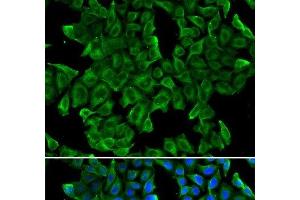 Immunofluorescence analysis of MCF-7 cells using REG3G Polyclonal Antibody (REG3g anticorps)