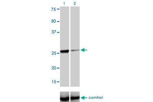 Western blot analysis of TGIF2 over-expressed 293 cell line, cotransfected with TGIF2 Validated Chimera RNAi (Lane 2) or non-transfected control (Lane 1).