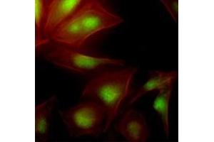 Immunofluorescenitrocellulosee of human HeLa cells stained with Phalloidin-TRITC (Red) for Actin staining and monoclonal anti-human UBE2S antibody (1:500) with Alexa 488 (Green). (UBE2S anticorps  (AA 1-222))
