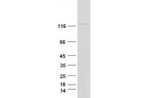 Validation with Western Blot