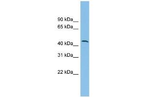 WB Suggested Anti-DPH1 Antibody Titration: 0. (DPH1 anticorps  (N-Term))